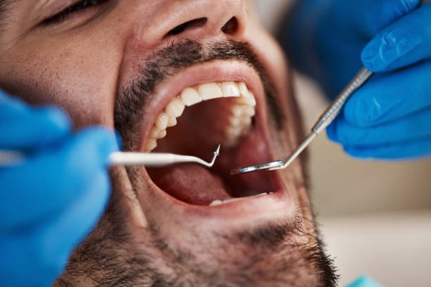 Best Urgent Dental Care for Toothaches in Salmon Brook, CT